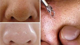 How To Do Facial Clean Up At Home Step By Step For Spotless Clear Skin Rabia Skincare [upl. by Rahel]