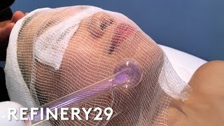 High Frequency Facial For Clear Skin  Beauty With Mi  Refinery29 [upl. by Nnaaihtnyc]