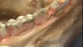 Introductory Periodontal Surgery Techniques Modified Widman Flap [upl. by Lraed325]