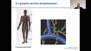 Video 1  Selbstmanagement in der Lymphologie  Grundlagen [upl. by Fillander]