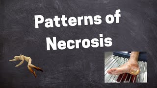 Morphology of Necrosis [upl. by Llekram]