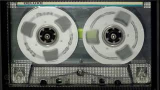 Yeshimebet Dubale የሺመቤት ዱባለ ጐዳናው ምን ይላል Ethiopian Music Oldies [upl. by Eedoj739]