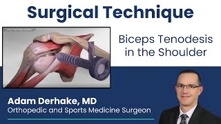 Biceps Tenodesis in the Shoulder Surgical Technique [upl. by Haidebez]