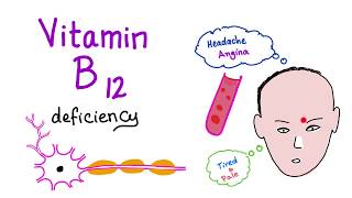 Vitamin B12 Cobalamin Deficiency  Causes Symptoms Diagnosis amp Management  Hematology Series [upl. by Shannon]