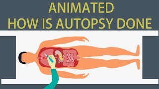 Autopsy Detailed animation on how is Autopsy done [upl. by Safoelc]