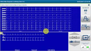 Welch Allyn® Diagnostic Cardiology Suite™ Resting ECG Workflow [upl. by Dranal684]