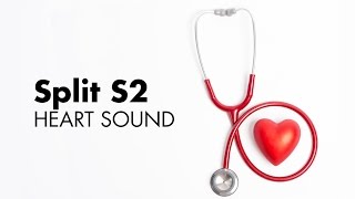 Fixed Split S2  Heart Sounds  MEDZCOOL [upl. by Jerrome]