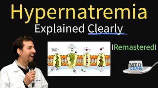 Hypernatremia Explained Types Diagnosis amp Treatment [upl. by Abagael306]