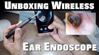 Unboxing Wireless Ear Endoscope  The Real Deal [upl. by Merralee]