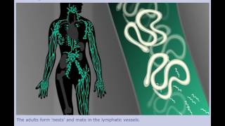 Lymphatic Filariasis Elephantiasis  Life Cycle [upl. by Nidraj]