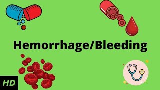 Hemorrhage bleeding Causes Signs and Symptoms Diagnosis and Treatment [upl. by Donoho]