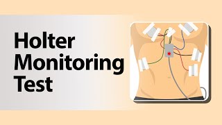 Holter Monitoring Test [upl. by Avigdor]