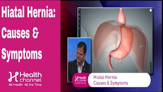 Hiatal Hernia Causes amp Symptoms [upl. by Irianat]