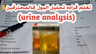 تعلم قراءه تحليل البول كالمحترفين urine analysis [upl. by Skippy]