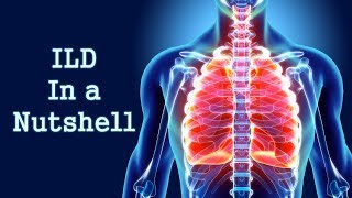 Interstitial Lung Disease ILD Overview– Interstitial Lung Disease  Lecturio [upl. by Ecyob]