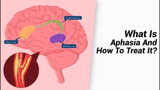 What Is Aphasia And How To Treat It [upl. by Tioneb]