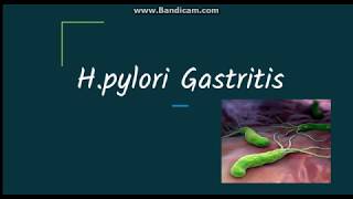 Helicobacter pylori gastritis Pathogenesis and morphology [upl. by Nettle42]