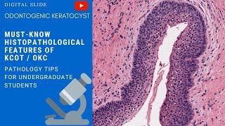 Odontogenic Keratocyst Histopathology [upl. by Mrots522]