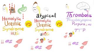 HUS vs aHUS vs TTP [upl. by Fayette]