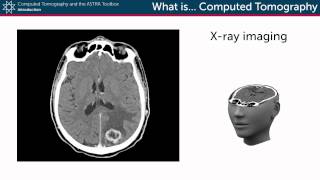 What is Computed Tomography [upl. by Fattal509]