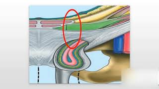 Inguinal Hernias Explained [upl. by Stacie861]