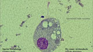 Sperm morphologyRound cells [upl. by Rives]