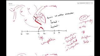 Hypertrophic Cardiomyopathy HCM Innovative Options for Treatment [upl. by Yrrehs369]