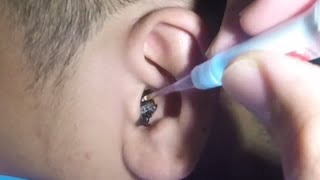 Massive Earwax Removal in One Piece The Best Technique [upl. by Godden]