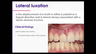 11 Traumatic Dental Injuries Part 2 Luxation Injuries Type 4 Lateral Luxations [upl. by Aiuqram594]