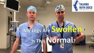 Swollen Legs Is That Normal After Surgery [upl. by Fannie]