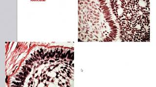 Odontogenic Tumors [upl. by Attennot654]