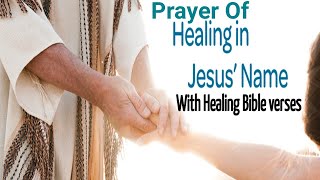 Healing Prayer With Healing Bible Verses [upl. by Ruenhs]