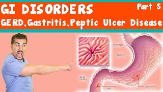 GI Disorders GERD Gastritis peptic ulcer Disease Part 5 [upl. by Hanae]