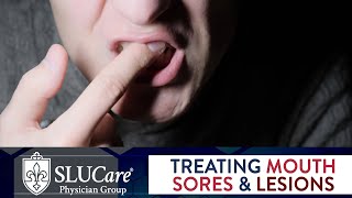 Mouth Sores amp Lesions Diagnosing and Treatment  SLUCare Otolaryngology [upl. by Ramoj]