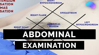 Abdominal Examination  OSCE Guide Latest  UKMLA  CPSA  PLAB 2 [upl. by Thormora228]