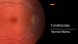 Retina  An Introduction  Part 1 [upl. by Mauer]