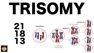 Trisomy 21 18 and 13 amp Nondisjunction Genetics [upl. by Bass250]