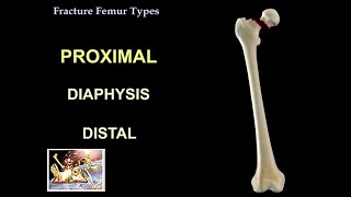 Ankle Recovery  Nerve Damage after Tibial Medial Malleolus Fracture from Motocross [upl. by Flight]