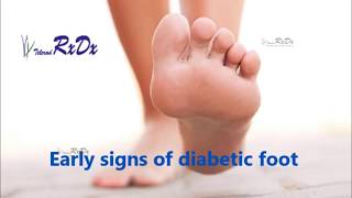 Early Signs of Diabetic Foot [upl. by Dorry]