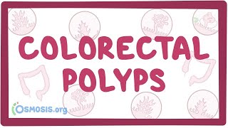 Colorectal polyps  an Osmosis Preview [upl. by Aneer]