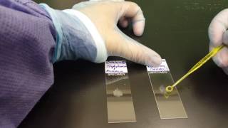 Microbiology the Catalase test [upl. by Urbanus831]