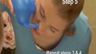 A nasal irrigation technique using a medical syringe ENG SUB [upl. by Abrams366]