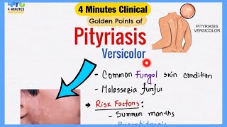 Pityriasis Versicolor Explained Like Water  Symptoms Pathogenesis Treatment  4 Minutes Clinical [upl. by Tandi]