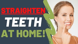 Straighten Your Teeth At Home NATURALLY  Dentist UPDATED 2021 [upl. by Meldoh]