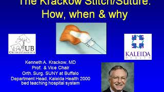 Krackow suturing indications amp technique profkenneth Krackow [upl. by Ahras]