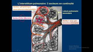 syndrome interstitiel en détails 01 [upl. by Egwan789]