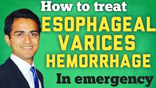 Esophageal Varices amp Variceal Hemorrhage Treatment and ManagmentSTEP WISE APPROACH [upl. by Lamek]