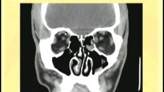 HEENT Assessment Part 1 Head Face and Neck [upl. by Mutua]