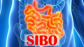 Small Intestinal Bacterial Overgrowth SIBO [upl. by Given]