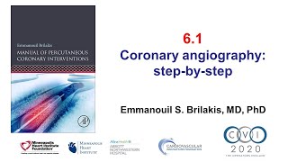 Angiogram and Coronary Angioplasty Procedure Cardiology [upl. by Vona947]